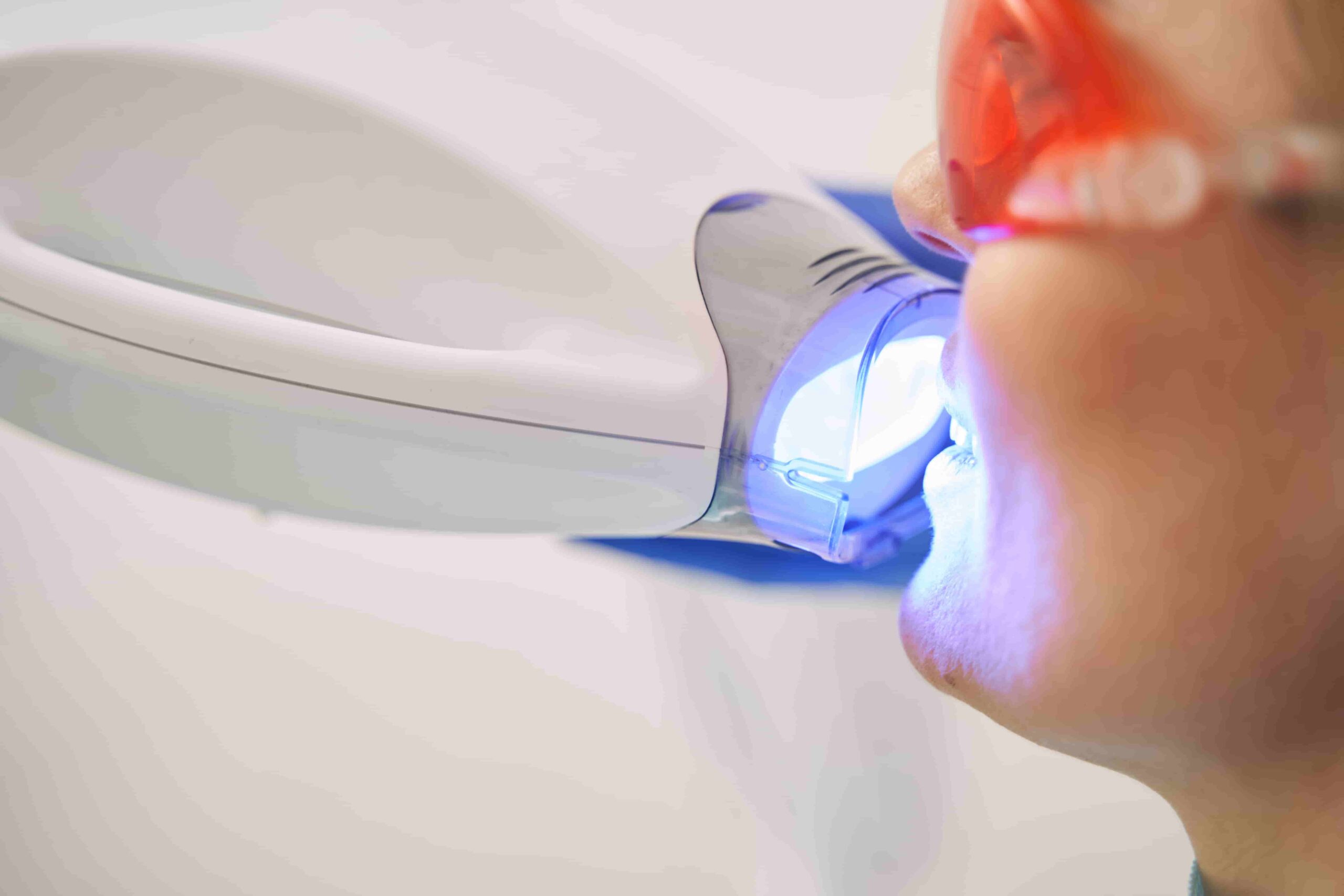 Cost for Laser Dentistry in Setia Alam, Shah Alam, Selangor Malaysia