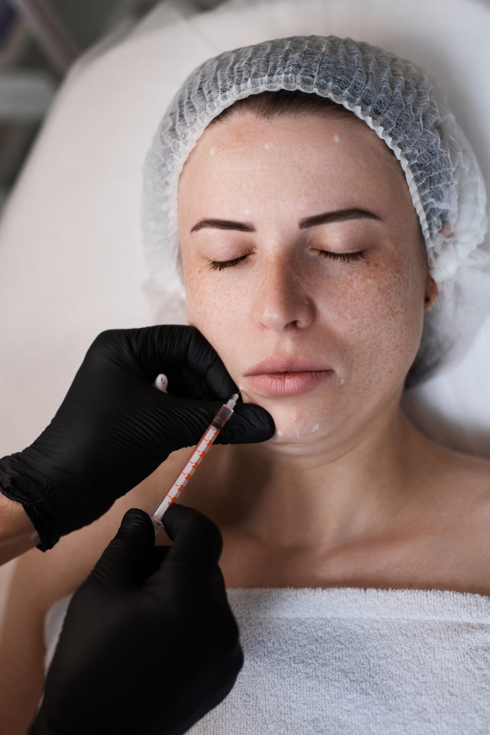 Botox and Fillers treatment in Setia Alam, Shah Alam, Selangor, Malaysia