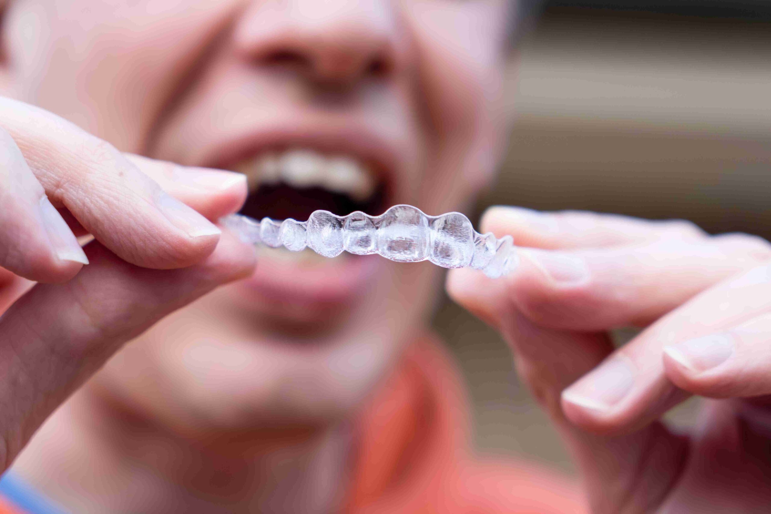 Invisalign Dental services in Setia Alam, Shah Alam, Malaysia